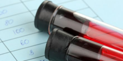CVS Health & Grindr: HIV Status Disclosures and Their Ediscovery Implications